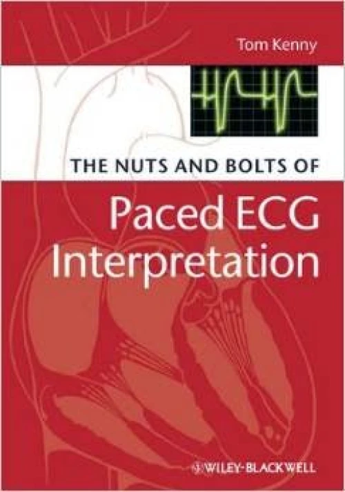 The Nuts and Bolts of Interpreting Paced ECGs and EGMs